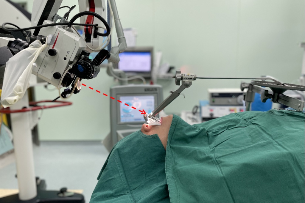 指示激光方向)相较于传统开放手术,二氧化碳激光手术具有以下四个优势